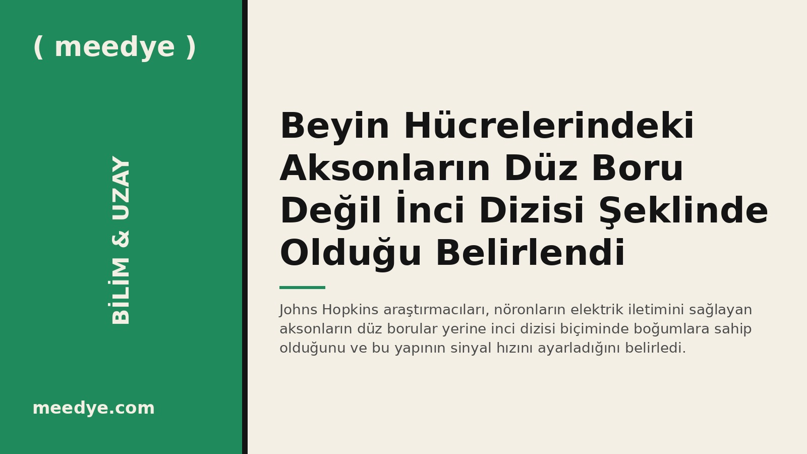Beyin Hücrelerindeki Aksonların Düz Boru Değil İnci Dizisi Şeklinde Olduğu Belirlendi — Meedye editoryal görseli